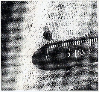implantat?